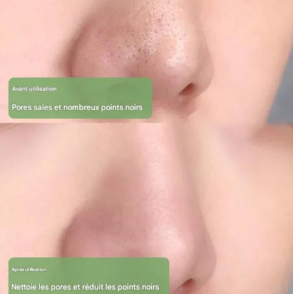 Diystar™ Masque Nettoyant en Profondeur au Thé Vert 100% Naturel