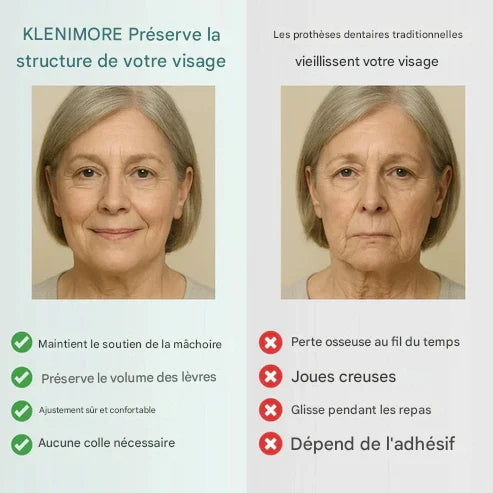 KLENIMORE™ Prothèse Dentaire Complète Médicale avec Forte Succion