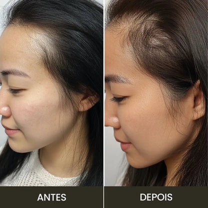 Escova de Terapia Capilar: TheraBrush Smarts 4 em 1