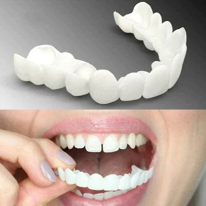 facetas dentárias Natural Removível (Superior e Inferior)